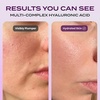 image:imageBody Restore Niacinamide Toner Pads Hyaluronic Acid  Cooling Jelly 60 CtToner Pads  Bakuchiol