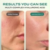 image:imageBody Restore Niacinamide Toner Pads Hyaluronic Acid  Cooling Jelly 60 CtToner Pads  Cooling Jelly
